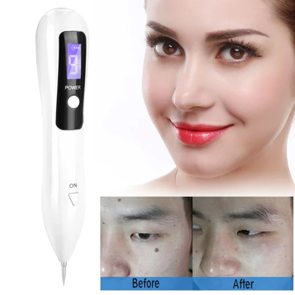 Spot Removal Machine Portable LCD Dot Mole Freckle Spot Tattoo Removal Pen Beauty Skin Machine Freckle Removal Machine